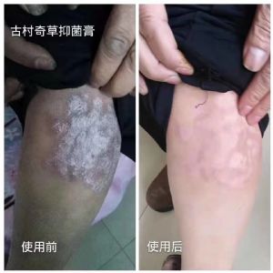 古村奇草药膏 厂价直销 免费招代理 批发价多少