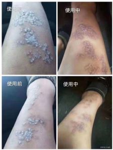 古村奇草药膏 多少钱一支？哪里有卖的？