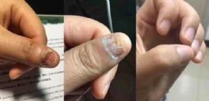 古村奇草代理价是多少？一次要拿多少盒？