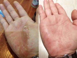 古村奇草药膏代理拿货多少？怎么代理呢？